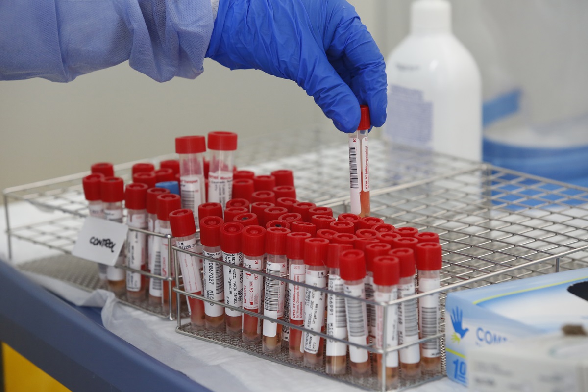 Tubos de pruebas PCR para la detección del COVID-19. EUROPA PRESS