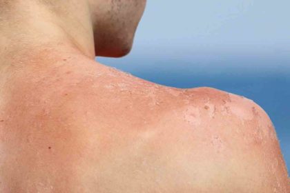 Alertas Canarias calor rayos ultravioleta