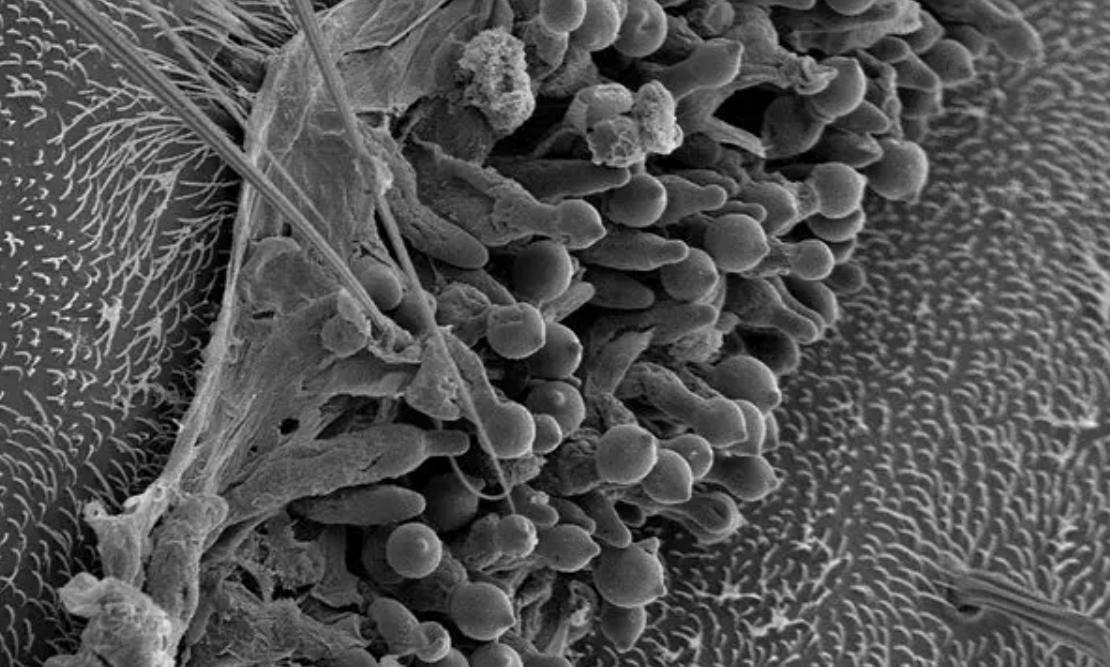 Hongo Entomophthora muscae en una mosca, imagen de los científicos
