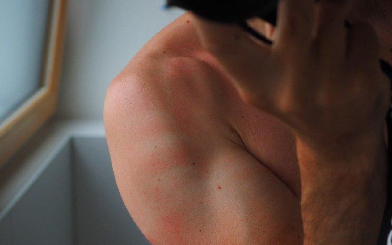 Imagen del cielo soleado en Canarias con aviso sanitario por radiación UV alta y recomendaciones de protección solar emitidas por Salud Pública.