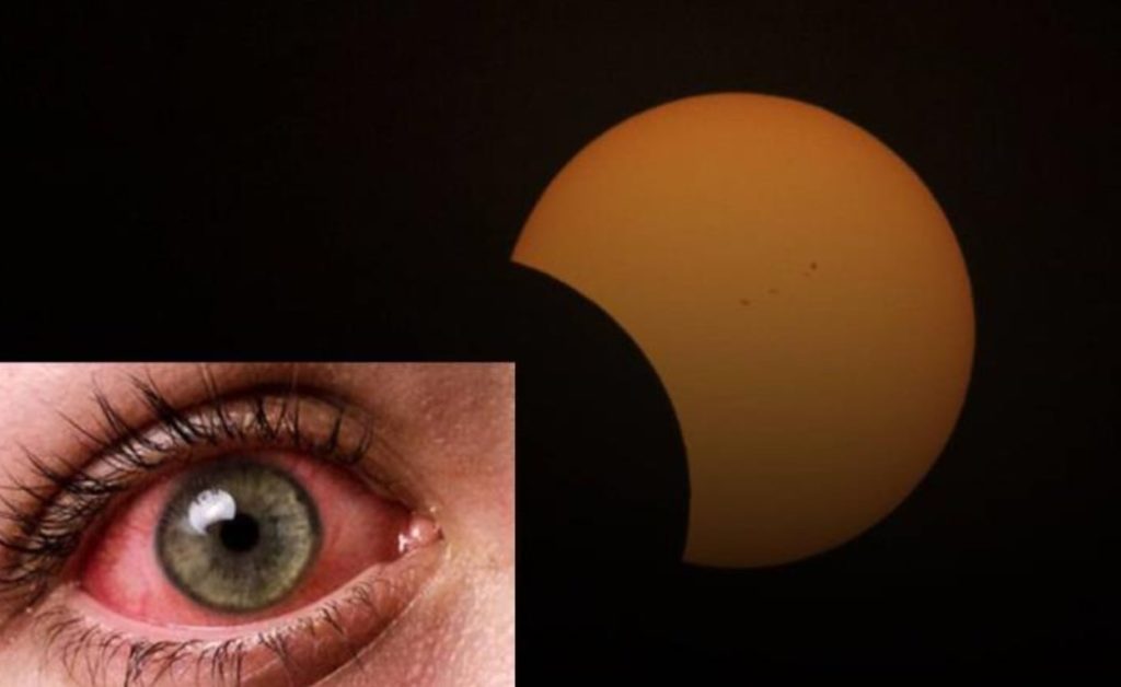 Ceguera al ver el eclipse solar