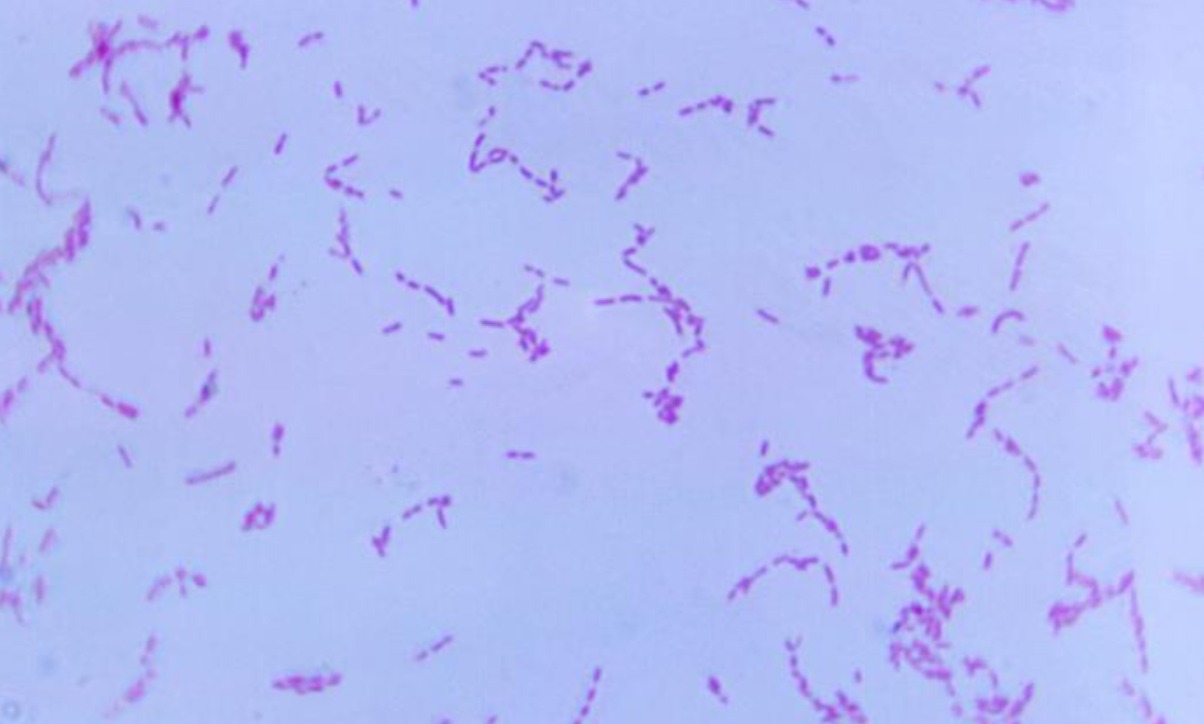 Bacteria Erysipelothrix rhusiopathiae. CDC Public Health Library (PHIL).
