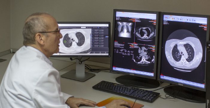 Este nuevo análisis de sangre detecta el cáncer de pulmón 4 años antes de los síntomas