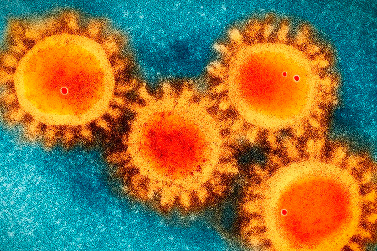Foto de microscopio electrónico del coronavirus Covid-19