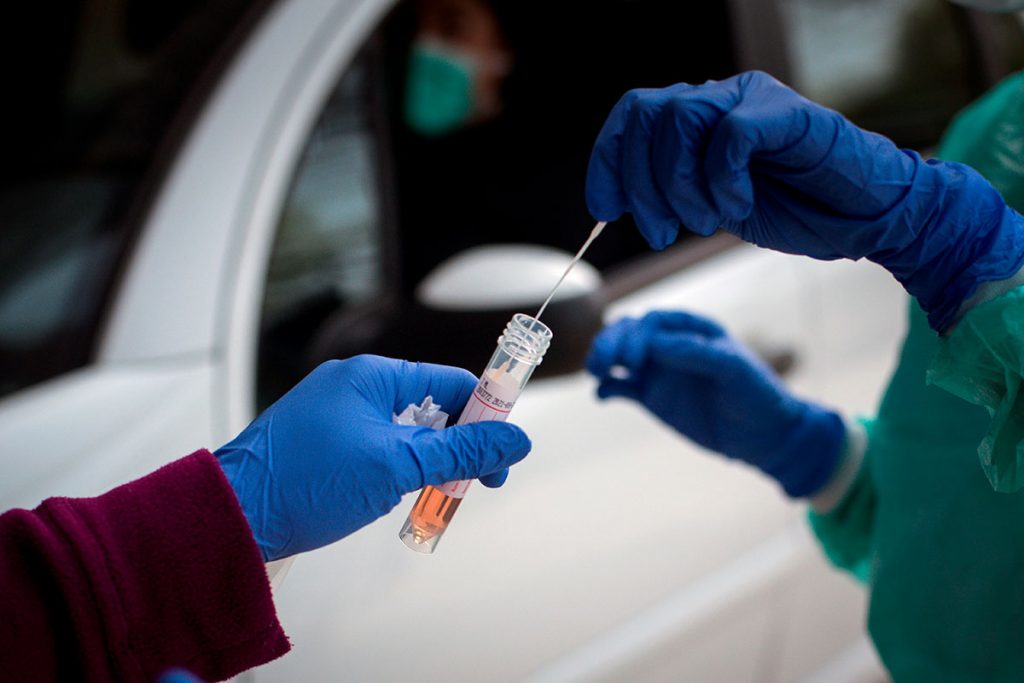 El consorcio alemán Bosch desarrolla un test rápido para el coronavirus