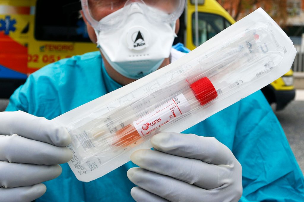 TEST RÁPIDO PCR CORONAVIRUS