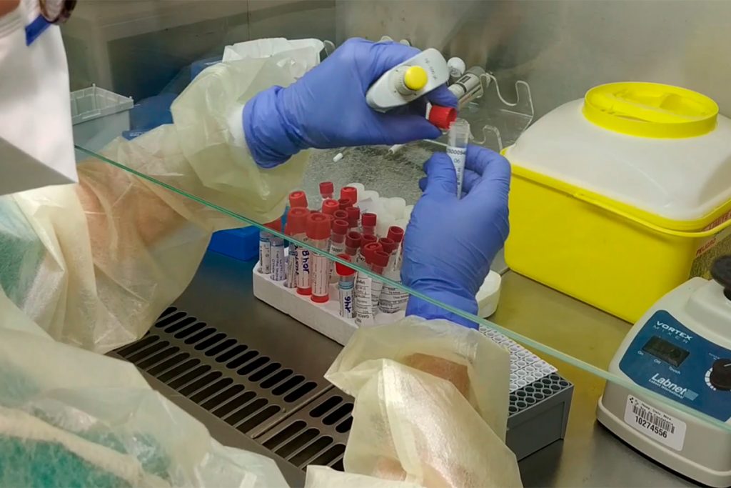 Investigadores del ITER y de La Candelaria aceleran el método de diagnóstico del Covid-19