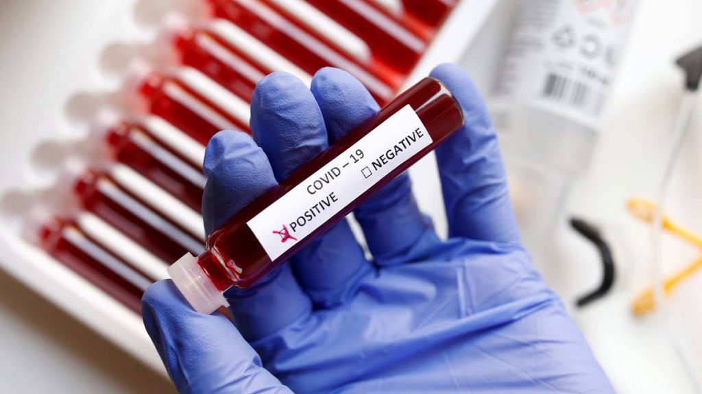 Las Islas registraron ayer 151 nuevos casos de coronavirus, dos fallecimientos y 143 altas médicas, en una semana que llama a la esperanza por haberse invertido la tendencia de la curva. Reuters