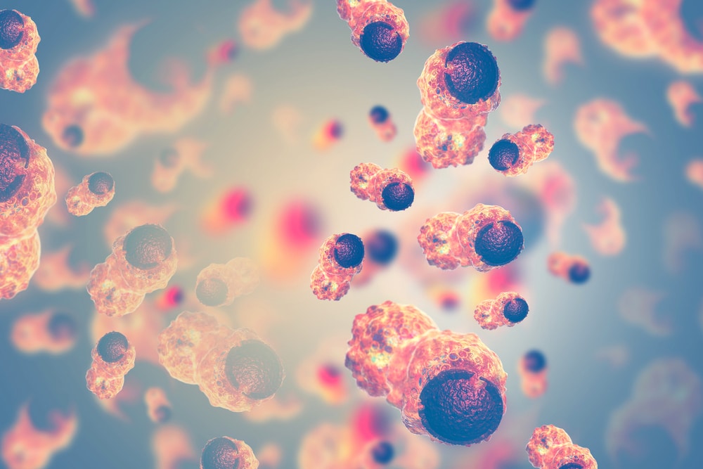 El nuevo test para la detección del cáncer de endometrio que se puede realizar en casa