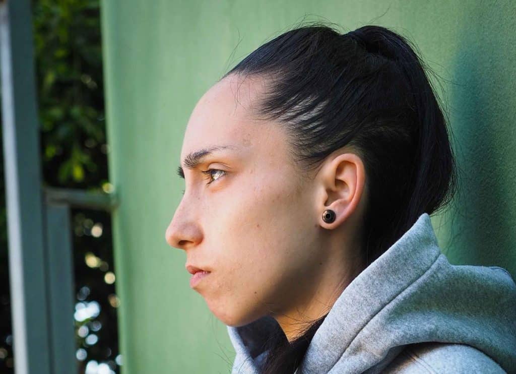 "Estoy en huelga de hambre e iré hasta el final para curarme de la anorexia"