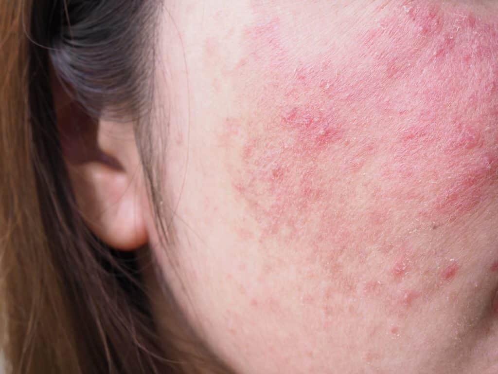 Sanidad alerta sobre estos populares tratamientos cosméticos y pide no usarlos