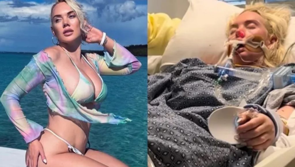 La tragedia de la modelo Jennifer Barlow: le amputan una pierna por una bacteria "carnívora"
