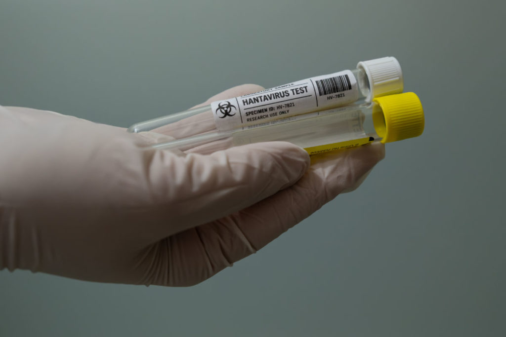 La mujer ingresada en Alicante por posible contagio de hantavirus da negativo en la PCR