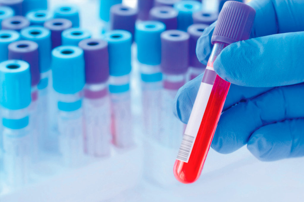 Preocupaci&oacute;n por el aumento de las infecciones sexuales en Canarias